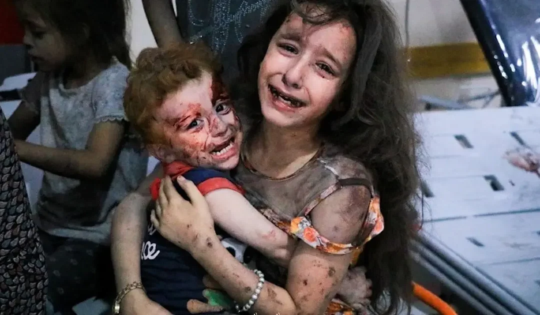 وفاة شابة فلسطينية في إسطنبول إثر سكتة قلبية مرتبطة بظروف الحرب في غزة